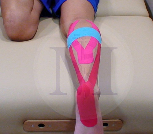 kinesio tape 2