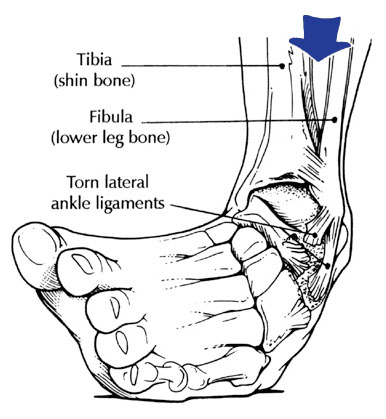 tibia