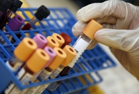 &Mu;&epsilon;&lambda;έ&tau;&eta; έ&delta;&epsilon;&iota;&xi;&epsilon; ό&tau;&iota; &omicron;&iota; &sigma;&tau;&alpha;&tau;ί&nu;&epsilon;&sigmaf; &mu;&epsilon;&iota;ώ&nu;&omicron;&upsilon;&nu; &tau;&omicron;&nu; &kappa;ί&nu;&delta;&upsilon;&nu;&omicron; &gamma;&iota;&alpha; &alpha;&rho;&theta;&rho;ί&tau;&iota;&delta;&alpha;